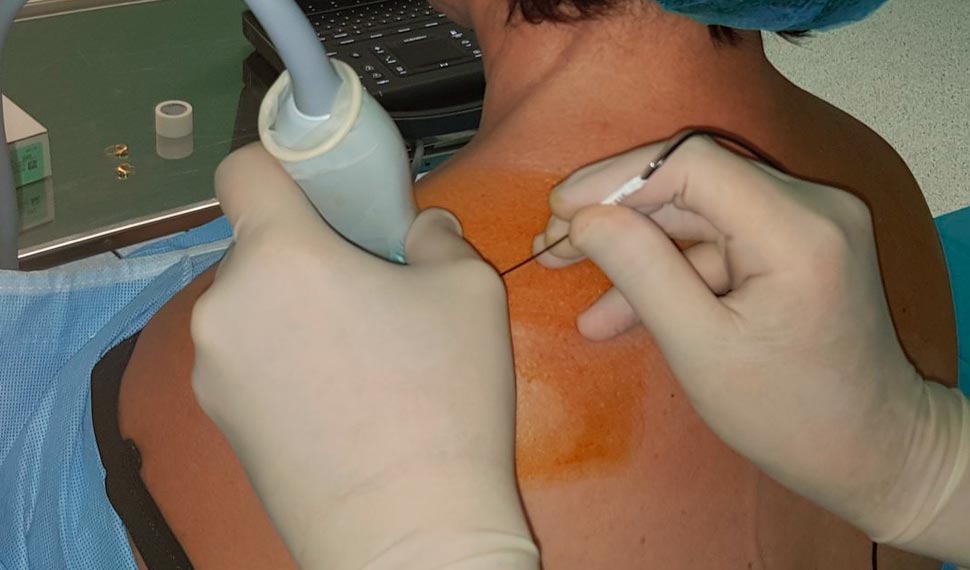 Our Project One Image 4