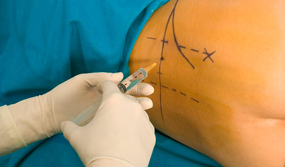 Our Project One Image 1