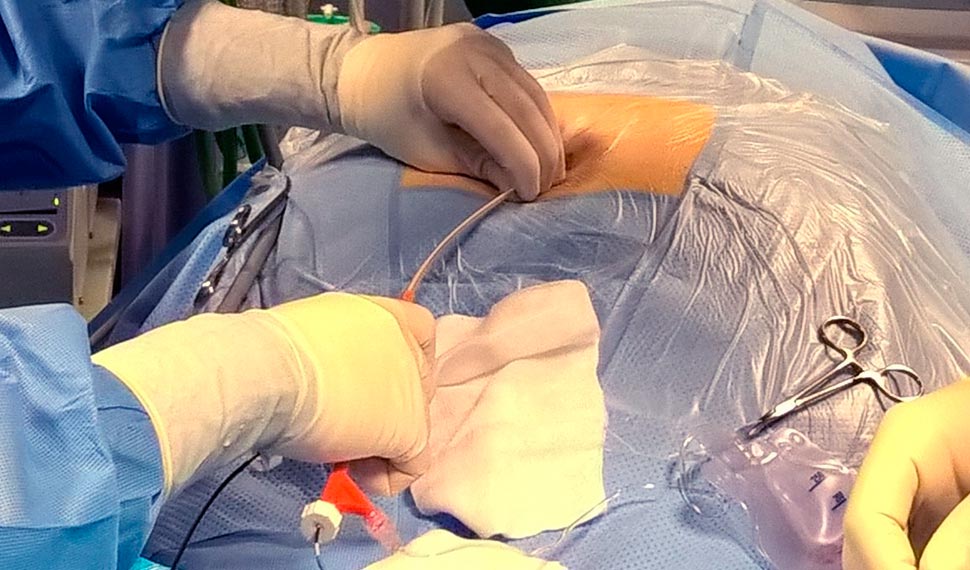 Our Project One Image 1